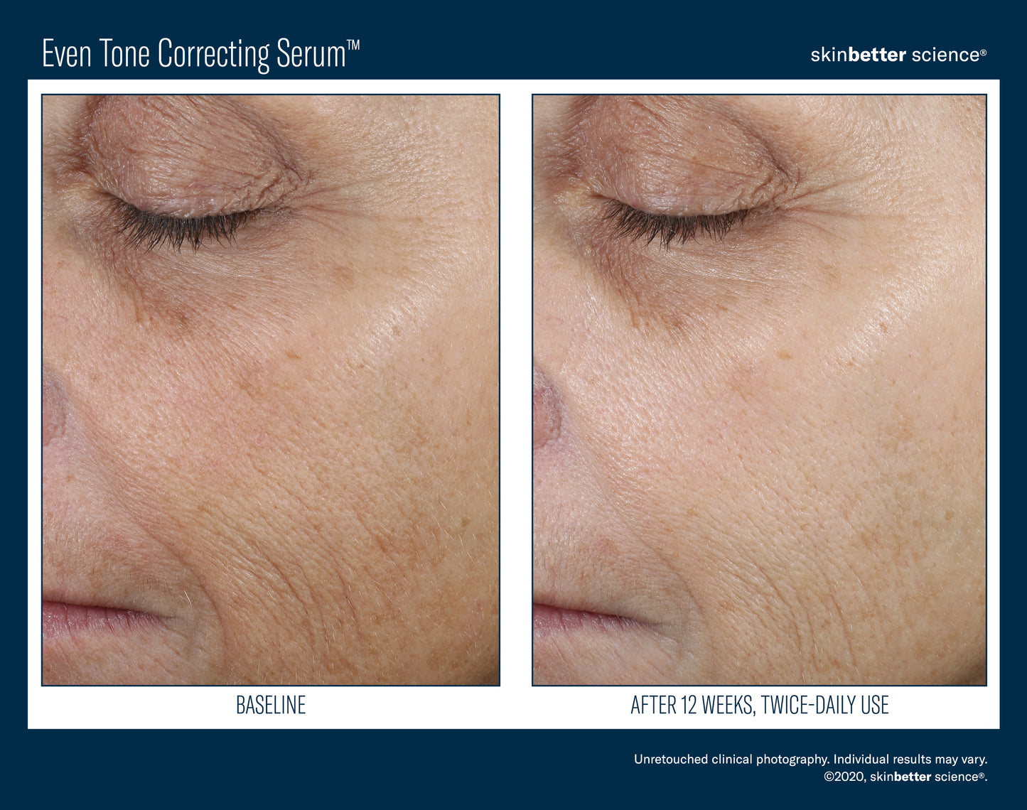 Even Intensive Skin Tone Correcting Serum