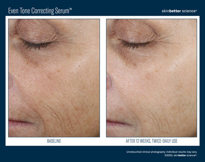 Even Intensive Skin Tone Correcting Serum